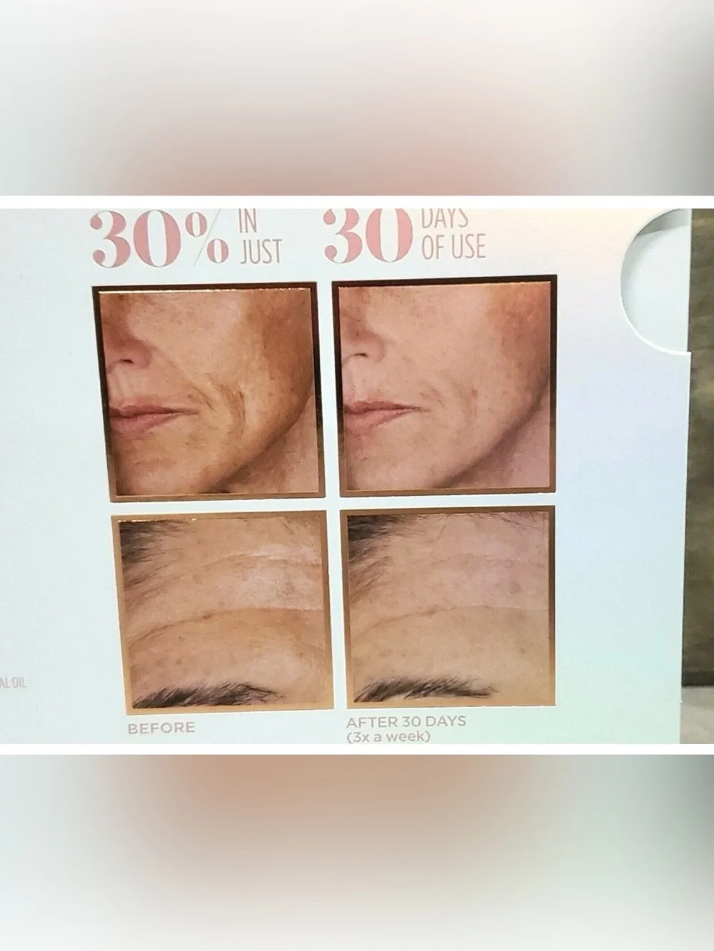 ~BeautyBio GloPRO Microneedling Regeneration Tool face and body